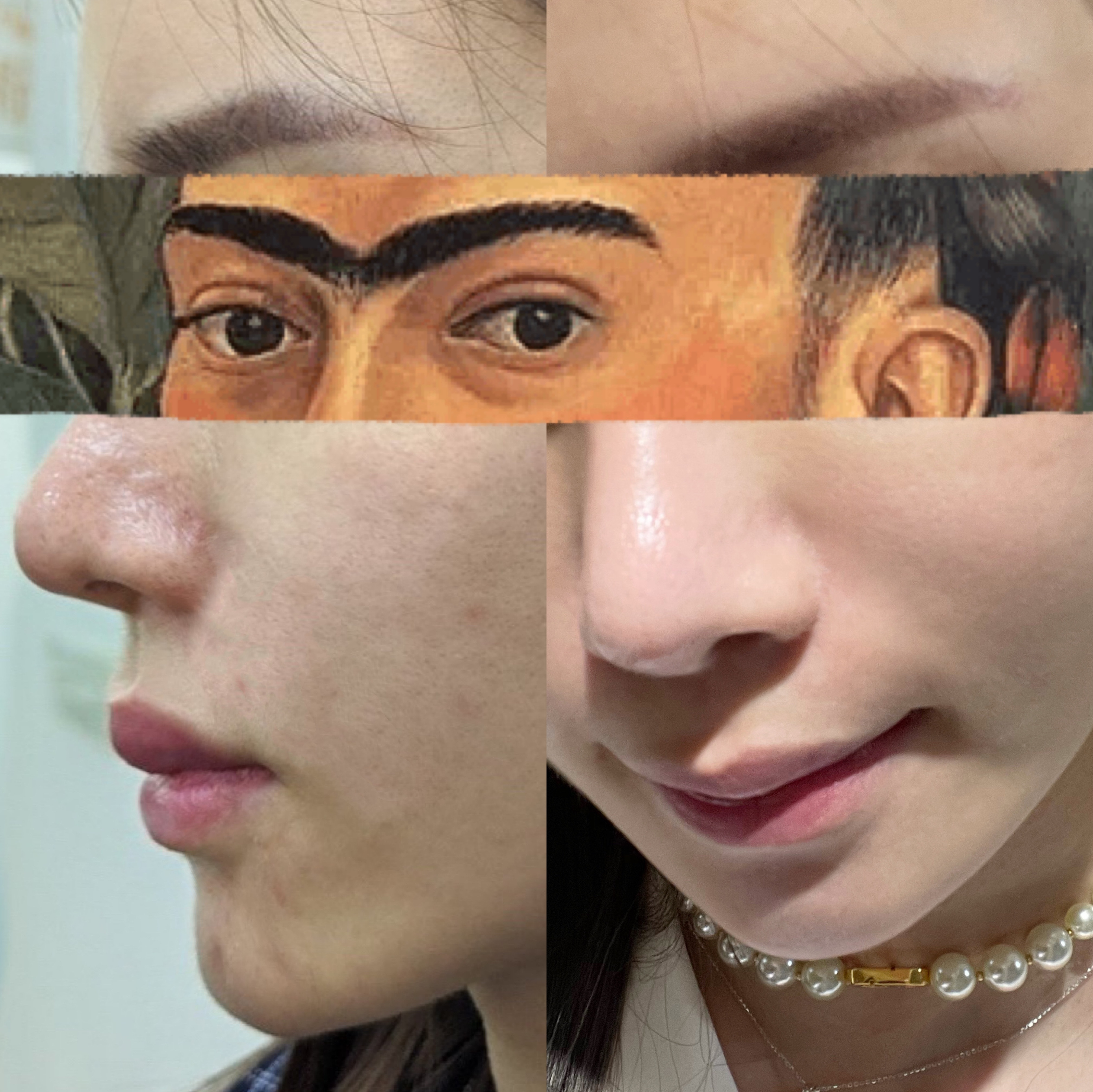 CHIKO初肽生肌面膜2.0