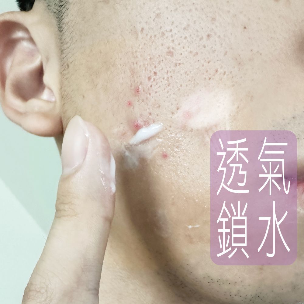 【痘肌鎖水】透氣乳霜🌼買三優惠 童學-美肌洞洞／台灣研發／首創雙微技術／透氣保護膜／滋潤／保濕／男女混合肌適用