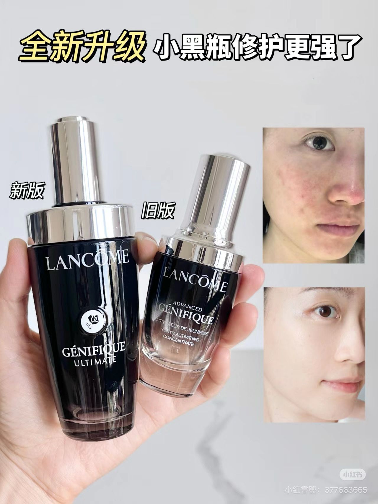 🔥蘭蔻小黑瓶 超未來肌因賦活露