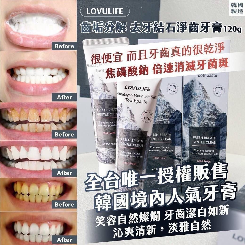 🇰🇷韓國製造 LOVULIFE齒垢分解 去牙結石淨齒牙膏120g