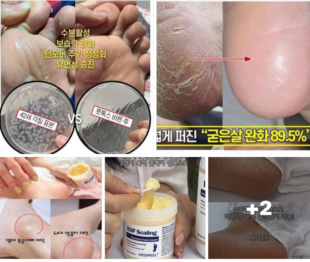 👣【韓國 MEDIPEEL EGF 美蒂菲嫩足修復霜】130g