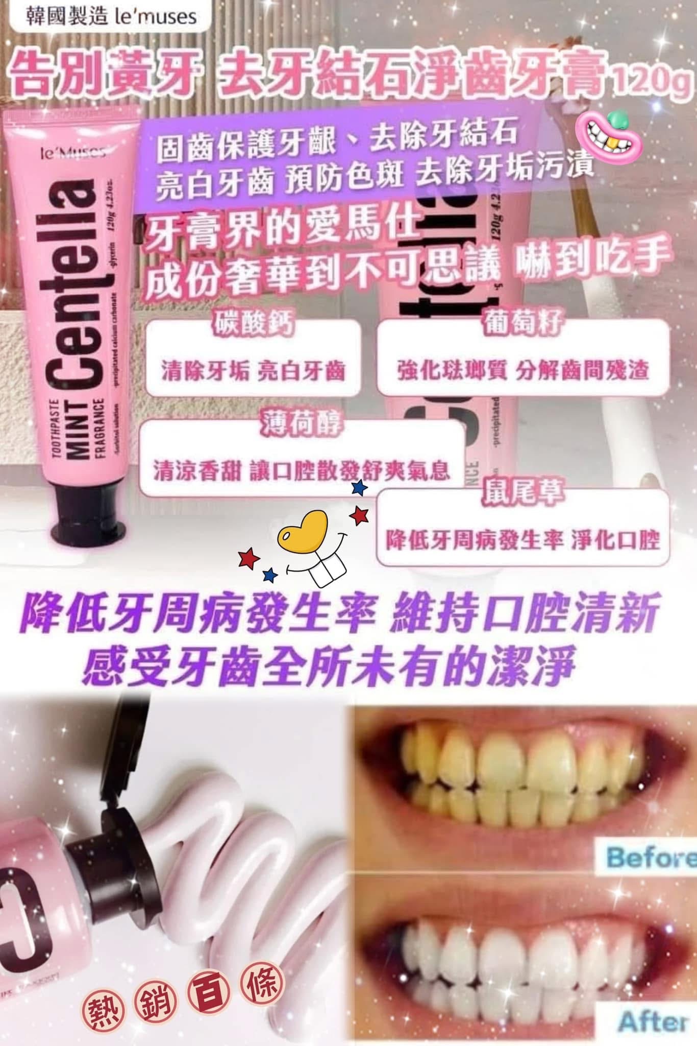 韓國🇰🇷le’muses告別黃牙 去牙結石淨齒牙高120g